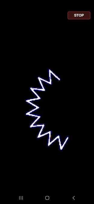 Migraine aura visual simulation showing zigzag flashing pattern similar to scintillating scotoma